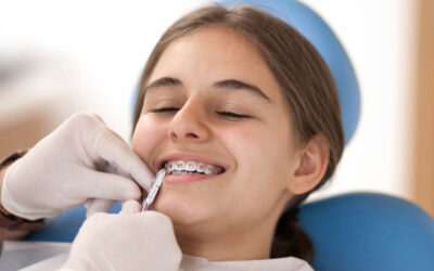 Braces Glow-Up: What to Expect from Start to Finish