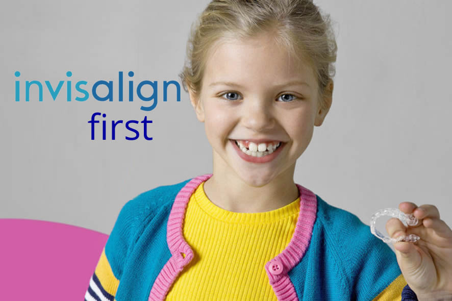 invisalign first